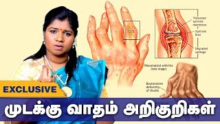 முடக்கு வாதம் அறிகுறிகள் தீர்வு என்ன  arthritis Siddha Treatment  Tamil health tips [upl. by Meghann]