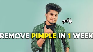 HOW TO REMOVE PIMPLE PERMANENTLY  IN TAMIL  SARAN LIFESTYLE [upl. by Bowlds474]