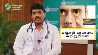 How to find Jaundice Symptoms  Jaundice Treatment  Advice from Dr Mahudeswaran  Shanmuga Hospital [upl. by Ardyth531]