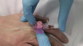 Cannulation How to gain IV access [upl. by Owen]