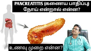 Pancreatitis causesamptreatment explanation in tamilmedical awareness in tamil [upl. by Andriette]