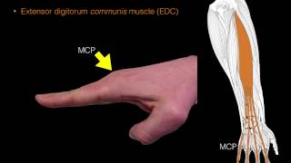 Forearm extensor muscles [upl. by Trelu]